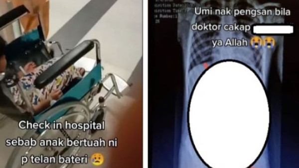 Bocah telan 6 baterai tengah di kursi roda. (net)-1635237648