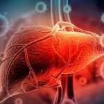 Hepatitis-1671437443