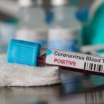 sample darah-1674713517