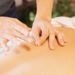 Ilustrasi akupunktur (ANTARA/Pexels)-1694422725